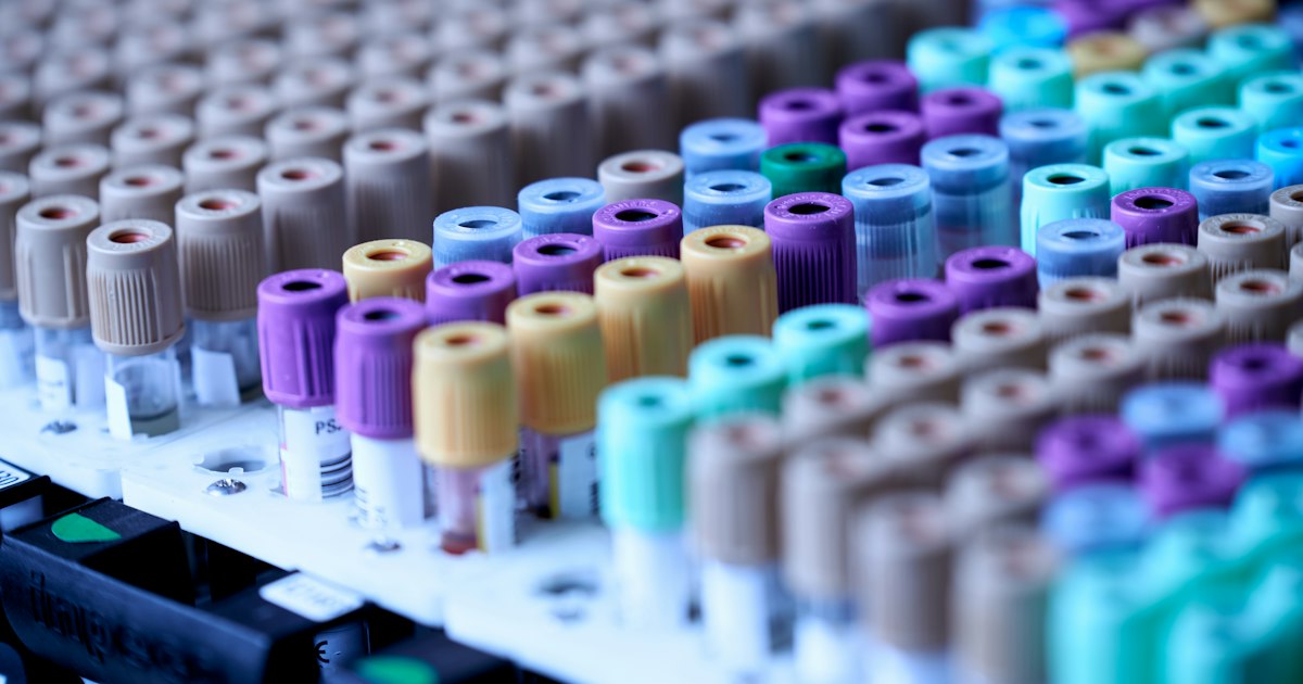 Vitamin D (25-OH): what the test shows and why it matters for the athlete